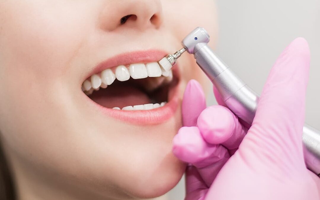 Pola. Sistema avanzado de blanqueamiento dental